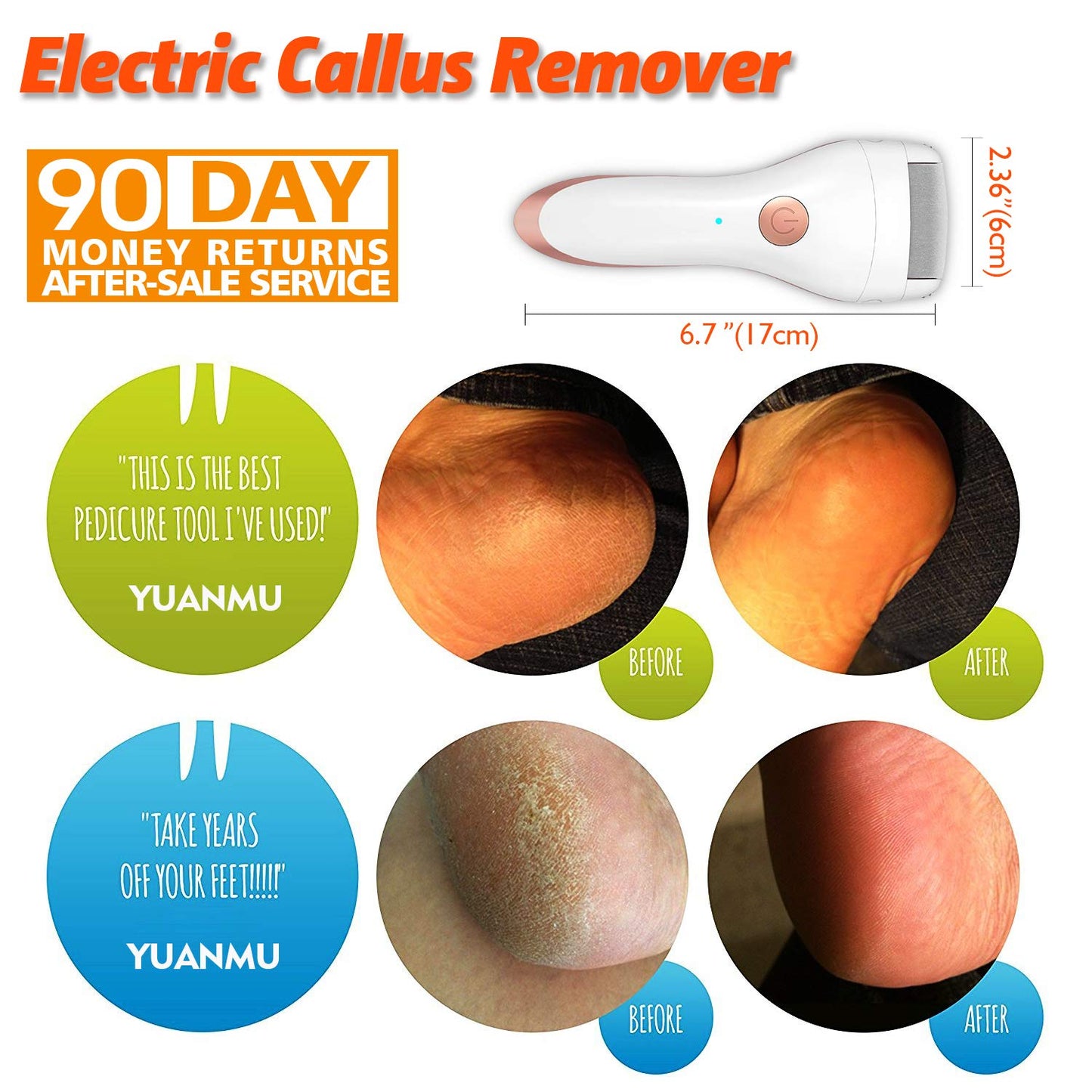 Electric Foot Callus Remover Portable Electronic Foot File Pedicure - Castle Anna