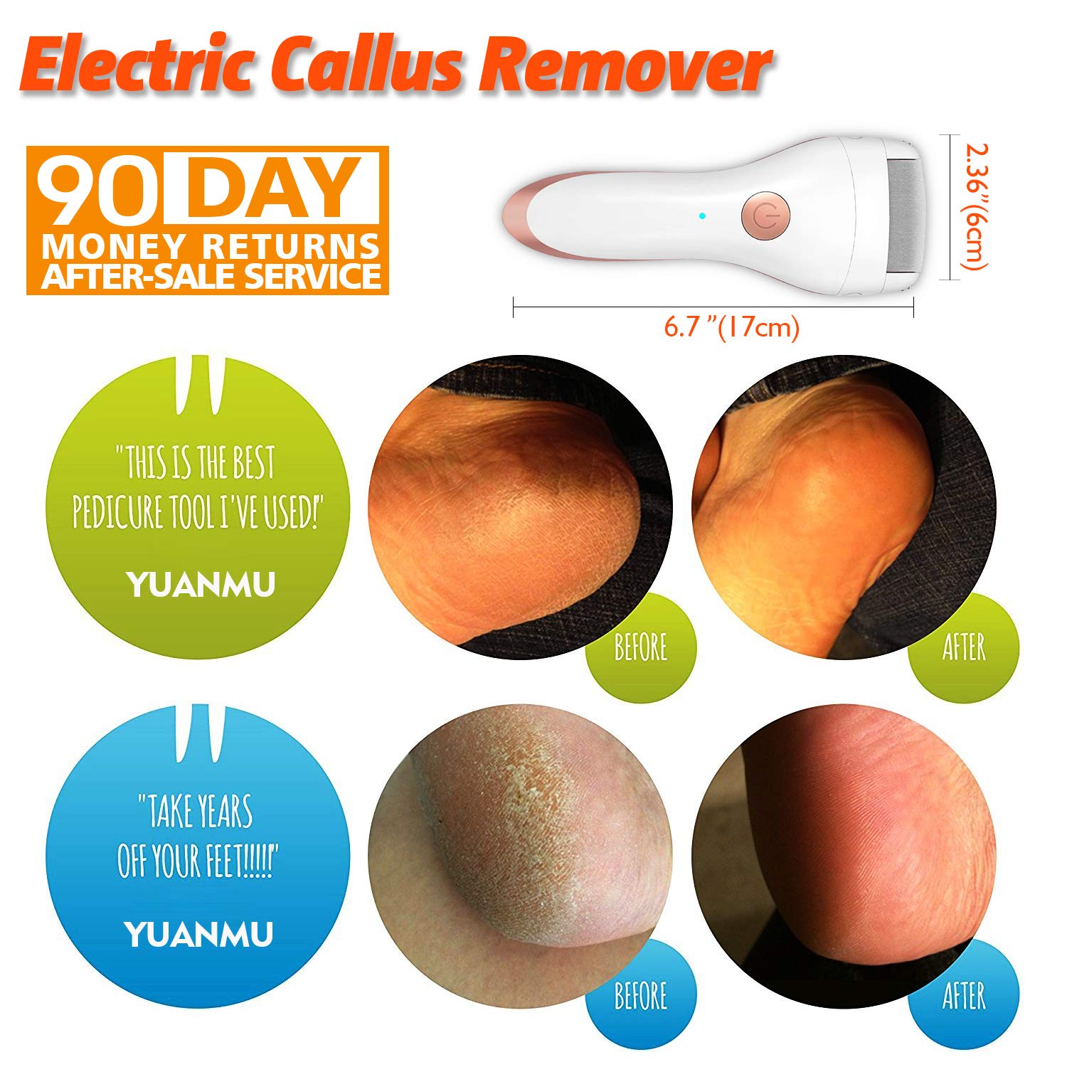 Electric Foot Callus Remover Portable Electronic Foot File Pedicure - Castle Anna